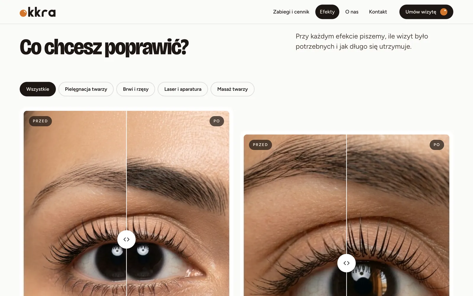 Strona Efekty z filtrami po rodzaju zabiegu i parami zdjęć przed i po